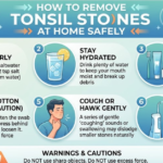 How to Remove Tonsil Stones at Home Safely
